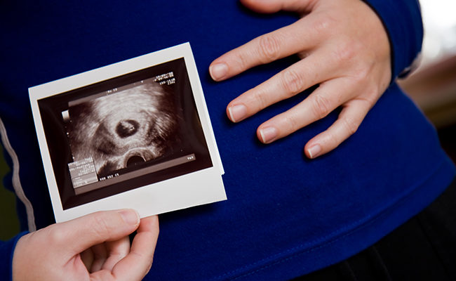abortion pro-life pro-choice polling