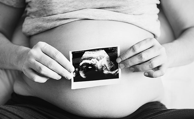 pregnant ultrasound abortion