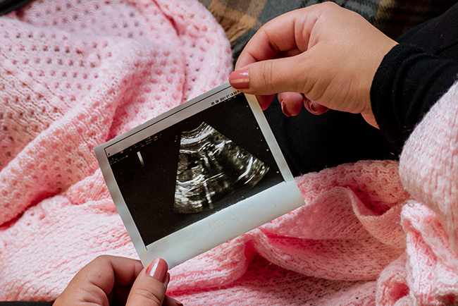 Woman holding ultrasound picture in post-Roe world