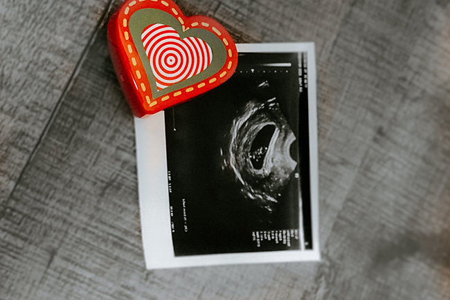 Red and white heart block laying on ultrasound picture - pregnancy loss