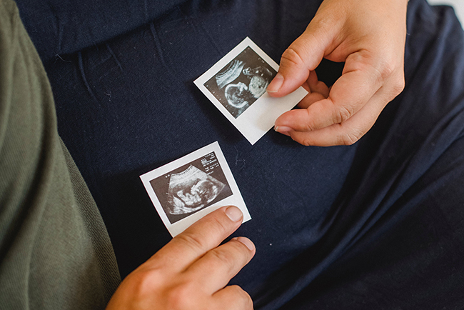 couple holding ultrasound images - assisted reproductive technology